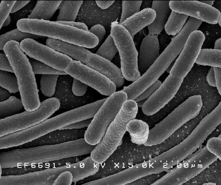 1. E. coli bacteria. Scanning electron micrograph of Escherichia coli bacteria, grown in culture and adhered to a cover slip. Photo Credit: Rocky Mountain Laboratories; NIAID Biodefense Image Library (http://www.niaid.nih.gov/Biodefense/Public/Images.htm), National Institute of Allergy and Infectious Diseases (NIAID, http://www.niaid.nih.gov), National Institutes of Health (NIH, http://www.nih.gov), United States Department of Health and Human Services (http://www.dhhs.gov), Government of the United States of America (USA).