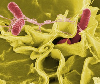 2. Salmonella bacteria. Color-enhanced scanning electron micrograph showing Salmonella typhimurium (colored red) invading cultured human cells. Photo Credit: Rocky Mountain Laboratories; NIAID Biodefense Image Library (http://www.niaid.nih.gov/Biodefense/Public/Images.htm), National Institute of Allergy and Infectious Diseases (NIAID, http://www.niaid.nih.gov), National Institutes of Health (NIH, http://www.nih.gov), United States Department of Health and Human Services (http://www.dhhs.gov), Government of the United States of America (USA).