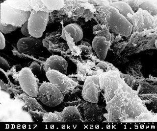 5. Yersinia pestis bacteria. Scanning electron micrograph depicting a mass of Yersinia pestis bacteria (the cause of bubonic plague) in the foregut of the flea vector. Photo Credit: Rocky Mountain Laboratories; NIAID Biodefense Image Library (http://www.niaid.nih.gov/Biodefense/Public/Images.htm), National Institute of Allergy and Infectious Diseases (NIAID, http://www.niaid.nih.gov), National Institutes of Health (NIH, http://www.nih.gov), United States Department of Health and Human Services (http://www.dhhs.gov), Government of the United States of America (USA).