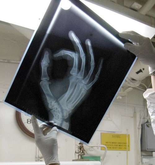 Studying an X-ray of a Broken Finger Aboard the United States Navy Aircraft Carrier USS Abraham Lincoln (CVN 72), February 11, 2005, Philippine Sea. Photo Credit: Photographer's Mate Airman Patrick M. Bonafede, Navy NewsStand  Eye on the Fleet Photo Gallery (http://www.news.navy.mil/view_photos.asp, 050211-N-1229B-034), United States Navy (USN, http://www.navy.mil); United States Department of Defense (DoD, http://www.DefenseLink.mil or http://www.dod.gov), Government of the United States of America (USA).