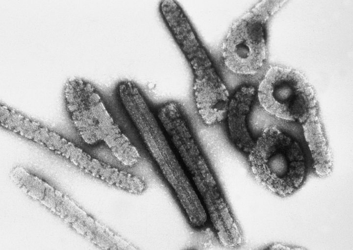 Magnified approximately 100,000 times, this negative stain image of an isolate of Marburg virus, a filovirus with membership in a family of often deadly RNA viruses called the Filoviridae, shows filamentous particles as well as the characteristic Shepherd's Crook shape. Photo Credit: Dr. Erskine Palmer and Russell Regnery, Ph.D., 1981, 'Transmission electron micrograph of Marburg virus', PHIL ID# 275, Public Health Image Library (PHIL, http://phil.cdc.gov), Centers for Disease Control and Prevention (CDC, http://www.cdc.gov), United States Department of Health and Human Services (http://www.dhhs.gov), Government of the United States of America (USA). Additional information from CDC Special Pathogens Branch: 'Filoviruses' <http://www.cdc.gov/ncidod/dvrd/spb/mnpages/dispages/filoviruses.htm> and 'Marburg Hemorrhagic Fever' <http://www.cdc.gov/ncidod/dvrd/spb/mnpages/dispages/marburg.htm>. The other deadly Filoviridae family member, Ebola Virus, is covered in ChamorroBible.org: Manguaguan na Palabran Si Yuus, Lumuhû (April) 30, 2005 <http://ChamorroBible.org/gpw/gpw-20050430.htm>.