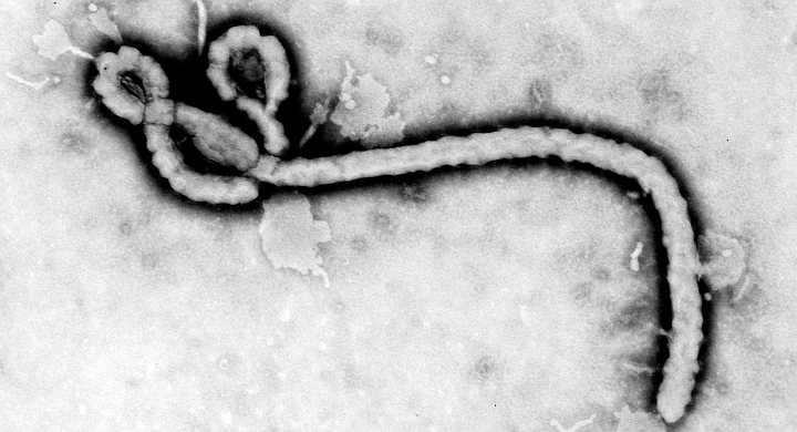 4. Transmission Electron Micrograph of Ebola Virus, the RNA Virus Which Causes Ebola Hemorrhagic Fever. Photo Credit: Frederick A. Murphy, 1976, "Transmission electron micrograph of Ebola virus", PHIL ID# 1181, Public Health Image Library (PHIL, http://phil.cdc.gov), Centers for Disease Control and Prevention (CDC, http://www.cdc.gov), United States Department of Health and Human Services (http://www.dhhs.gov), Government of the United States of America (USA). Additional information from CDC Special Pathogens Branch: "Filoviruses" <http://www.cdc.gov/ncidod/dvrd/spb/mnpages/dispages/filoviruses.htm> and "Ebola Hemorrhagic Fever" <http://www.cdc.gov/ncidod/dvrd/spb/mnpages/dispages/ebola.htm>. The other deadly Filoviridae family member, Marburg Virus, is covered in ChamorroBible.org: Manguaguan na Palabran Si Yuus, Lumuhû (April) 29, 2005 <http://ChamorroBible.org/gpw/gpw-20050429.htm>.