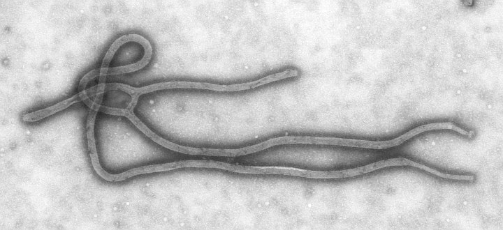 1. An Impressive View of a Transmission Electron Micrograph of the Often Deadly Ebola Virus. Photo Credit: Cynthia Goldsmith, "Transmission Electron Micrograph of the Ebola Virus. Hemorrhagic Fever, RNA Virus.", PHIL ID# 1832, Public Health Image Library (PHIL, http://phil.cdc.gov), Centers for Disease Control and Prevention (CDC, http://www.cdc.gov), United States Department of Health and Human Services (http://www.dhhs.gov), Government of the United States of America (USA). Additional information from CDC Special Pathogens Branch: "Filoviruses" <http://www.cdc.gov/ncidod/dvrd/spb/mnpages/dispages/filoviruses.htm> and "Ebola Hemorrhagic Fever" <http://www.cdc.gov/ncidod/dvrd/spb/mnpages/dispages/ebola.htm>. The other deadly Filoviridae family member, Marburg Virus, is covered in ChamorroBible.org: Manguaguan na Palabran Si Yuus, Lumuhû (April) 29, 2005 <http://ChamorroBible.org/gpw/gpw-20050429.htm>.