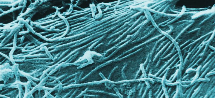 3. Scanning Electron Micrograph (SEM) Revealing a Number of Ebola Virions. Photo Credit: Cynthia Goldsmith, "This scanning electron micrograph (SEM) depicts a number of Ebola virions", PHIL ID# 1836, Public Health Image Library (PHIL, http://phil.cdc.gov), Centers for Disease Control and Prevention (CDC, http://www.cdc.gov), United States Department of Health and Human Services (http://www.dhhs.gov), Government of the United States of America (USA). Additional information from CDC Special Pathogens Branch: "Filoviruses" <http://www.cdc.gov/ncidod/dvrd/spb/mnpages/dispages/filoviruses.htm> and "Ebola Hemorrhagic Fever" <http://www.cdc.gov/ncidod/dvrd/spb/mnpages/dispages/ebola.htm>.  The other deadly Filoviridae family member, Marburg Virus, is covered in ChamorroBible.org: Manguaguan na Palabran Si Yuus, Lumuhû (April) 29, 2005 <http://ChamorroBible.org/gpw/gpw-20050429.htm>.