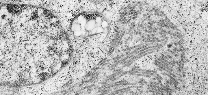 2. Intracytoplasmic Inclusion of Ebola Virus Nucleocapsids. Photo Credit: Dr. Fred Murphy, 1977, "This electron micrograph shows a thin section containing the Ebola virus, the causative agent for African Hemorrhagic Fever.", PHIL ID# 2738, Public Health Image Library (PHIL, http://phil.cdc.gov), Centers for Disease Control and Prevention (CDC, http://www.cdc.gov), United States Department of Health and Human Services (http://www.dhhs.gov), Government of the United States of America (USA). Additional information from CDC Special Pathogens Branch: "Filoviruses" <http://www.cdc.gov/ncidod/dvrd/spb/mnpages/dispages/filoviruses.htm> and "Ebola Hemorrhagic Fever" <http://www.cdc.gov/ncidod/dvrd/spb/mnpages/dispages/ebola.htm>. The other deadly Filoviridae family member, Marburg Virus, is covered in ChamorroBible.org: Manguaguan na Palabran Si Yuus, Lumuhû (April) 29, 2005 <http://ChamorroBible.org/gpw/gpw-20050429.htm>.