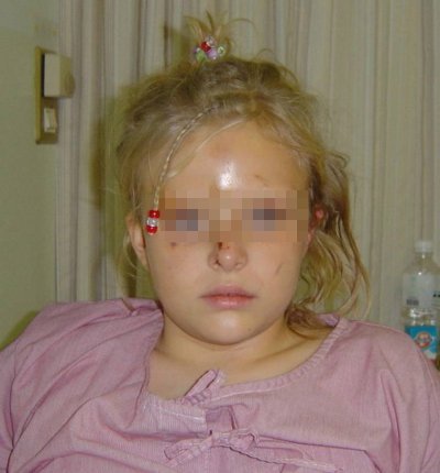 [foto della bambina]