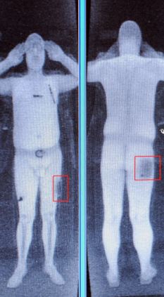 [body scanner image.jpg]