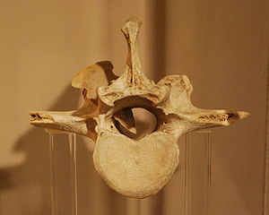 A native American arrowhead can be seen entering into the nerve channel in a Great Bison vertebra. This would have been a killing blow. This artifact dates back approximately 6,000 years.
