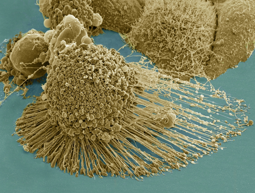 Death: The Genetically-Programmed and Genetically-Initiated Self-Destruction (Apoptosis or Programmed Cell Death) of A HeLa Cell. Photo Credit: HeLa-IV (http://imagebank.nih.gov/details.cfm?imageid=1463), NIH Image Bank (http://imagebank.nih.gov), National Institutes of Health (NIH, http://www.nih.gov), United States Department of Health and Human Services (http://www.dhhs.gov), Government of the United States of America (USA).