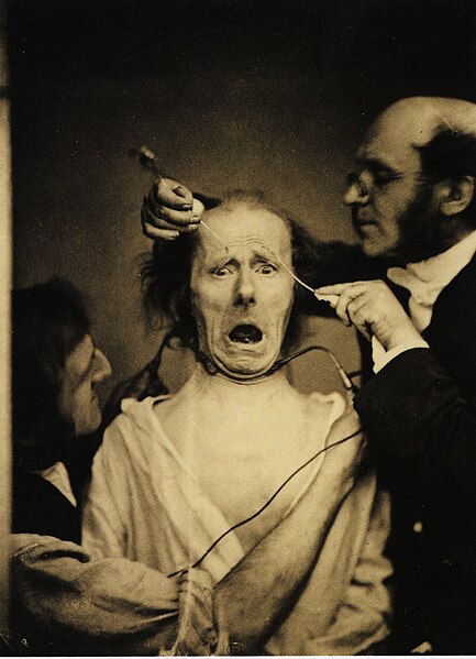 File:Guillaume Duchenne de Boulogne performing facial electrostimulus experiments.jpg