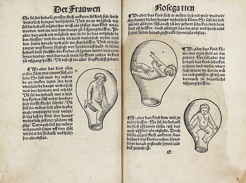 File:Der Swangern Frawen und Hebammen Roszengarten (1513) - 2.jpg